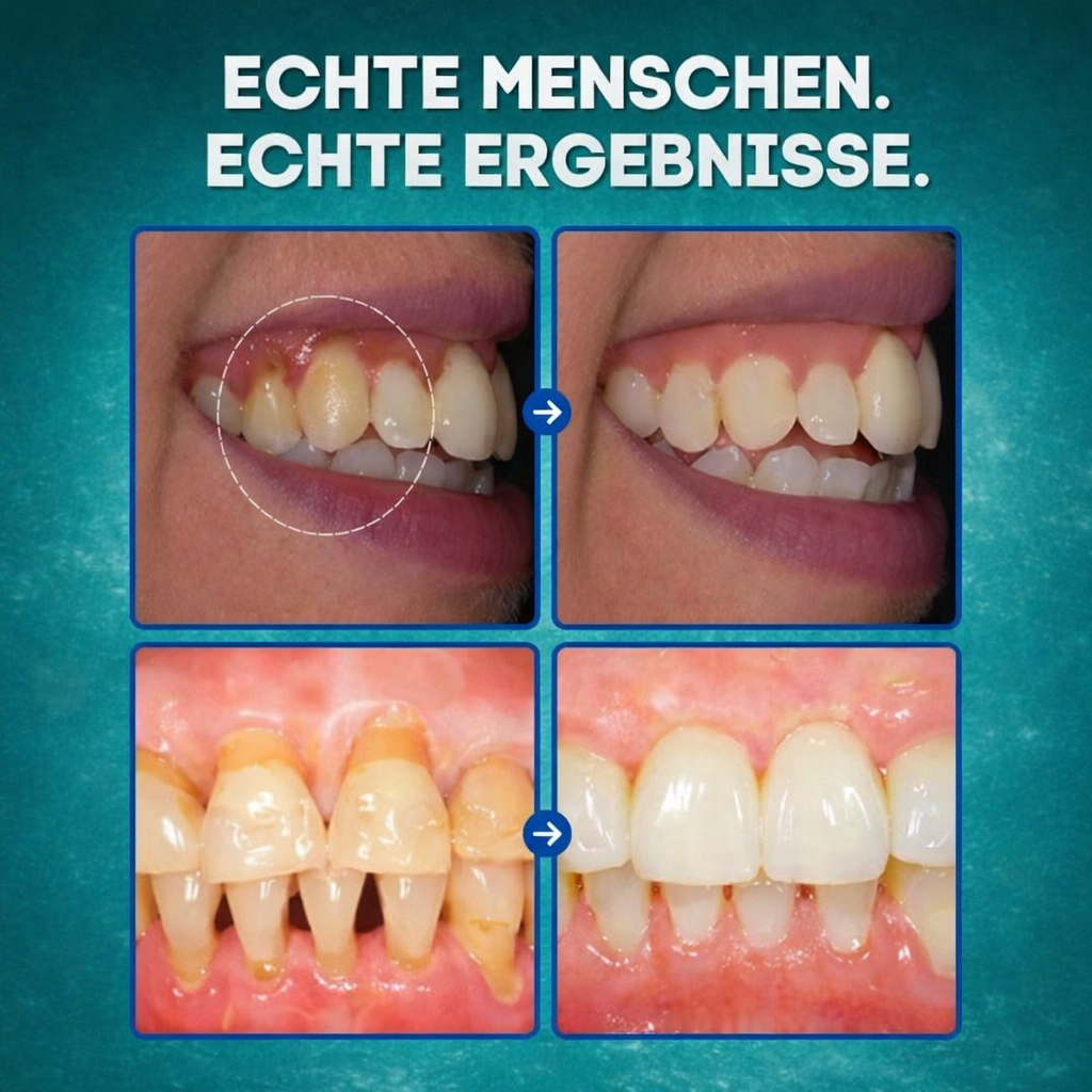 LächelPur™ Zahnfleisch Gel – Beruhigt & pflegt gereiztes Zahnfleisch